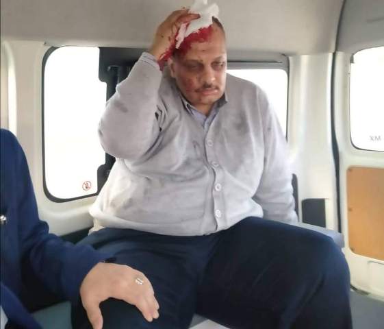 طالب بتجارة الإسكندرية يعتدى على أستاذه بطبنجة وبنزين